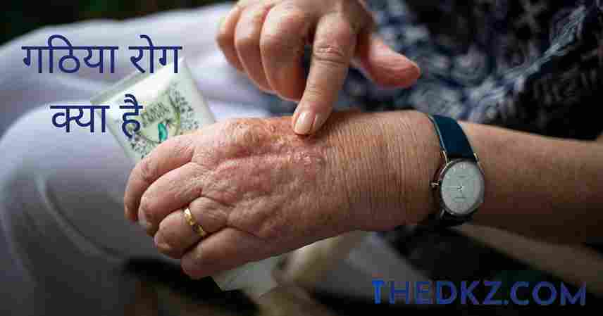 गठिया रोग क्या है - arthritis in hindi